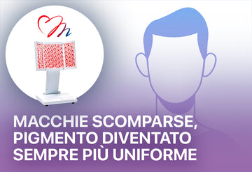 Macchie scomparse e pigmento più uniforme Proiettore di biofotoni
