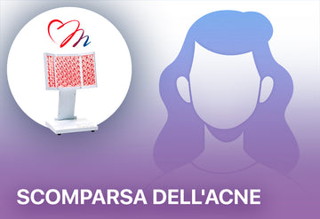 Acne scomparsa Proiettore di biofotoni